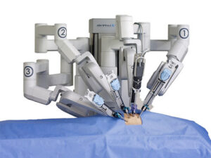 DaVinci robotic surgery cuts down on the time patients spend recuperating.